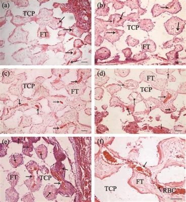  Bioceramiğin Diş Hekimliğinde ve Kemik Naklinde Kullanımı: Biyolojik Uyumluluğu ve Düşük Zararlı Etki ile Üstün Bir Materyal!